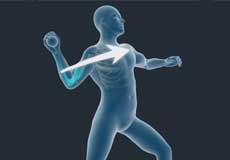 Throwing Injuries of the Shoulder